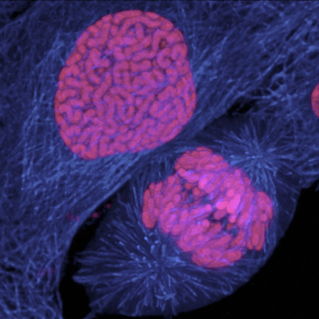 Tumor Cell Panels Help Researchers Develop New Cancer Treatments 