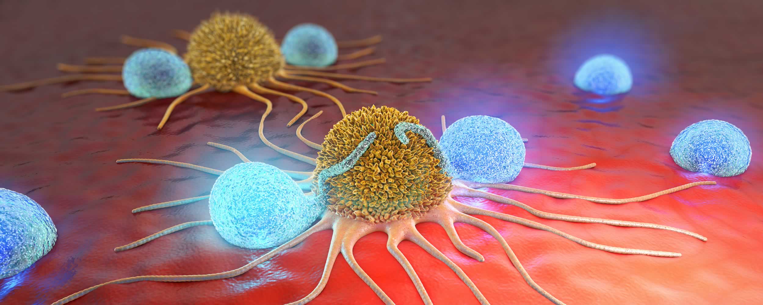 Cellule CAR-NK leucemia mieloide 