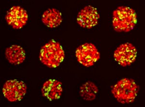  Cancer Spheroids, Image Courtesy of Molecular Devices 