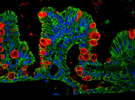 Novel 3D Cell Culture System Simplifies Tissue Culture Model Creation