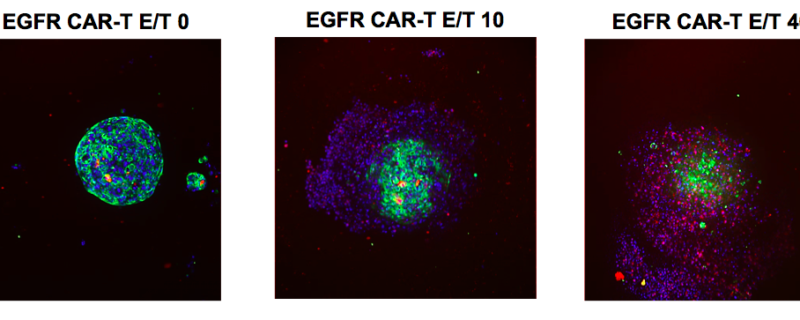A High Throughput System for CAR-T Cell Screening in Tumor