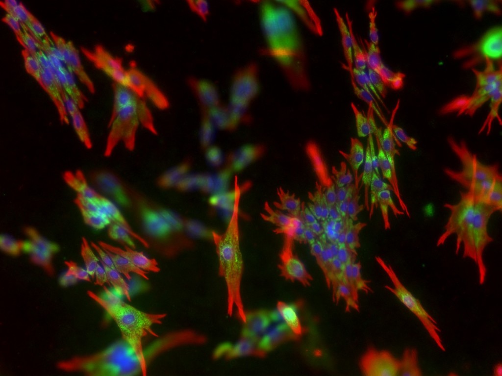 Neonatal dermal fibroblasts cultured in RAFT for 7 days, image courtesy of Lonza