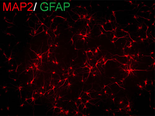 Figure 2 rat hippocampal neurons