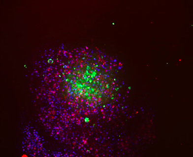 A High Throughput System for CAR-T Cell Screening in Tumor