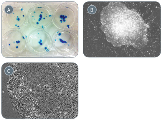 Generation of iPS Cells from 1 mL of Peripheral Blood