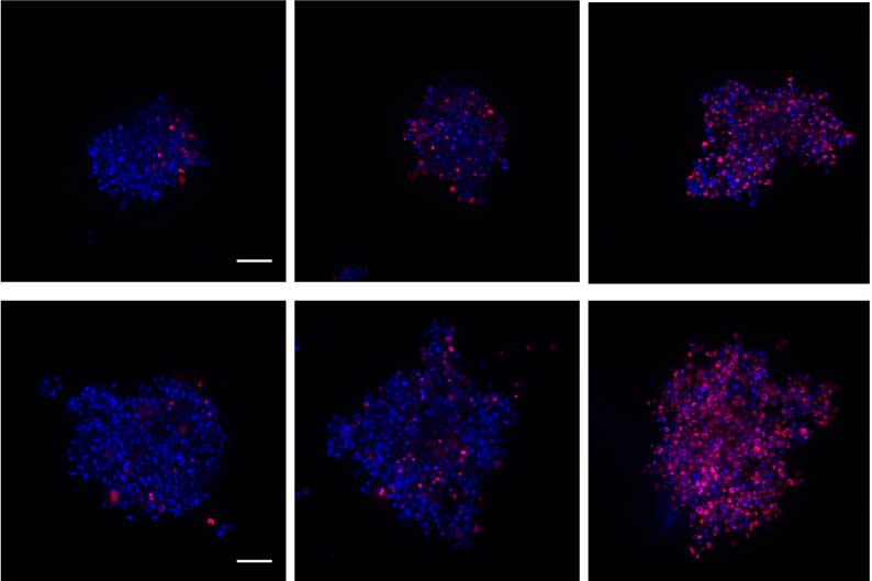 High-content imaging of spheroids within 1536-well spheroid microplate.