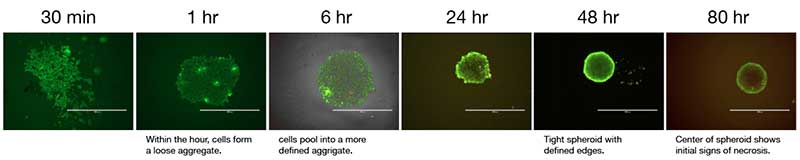 Live (green) and dead (red) stained HT-29 cells during spheroid formation in a 96-well Corning spheroid microplate