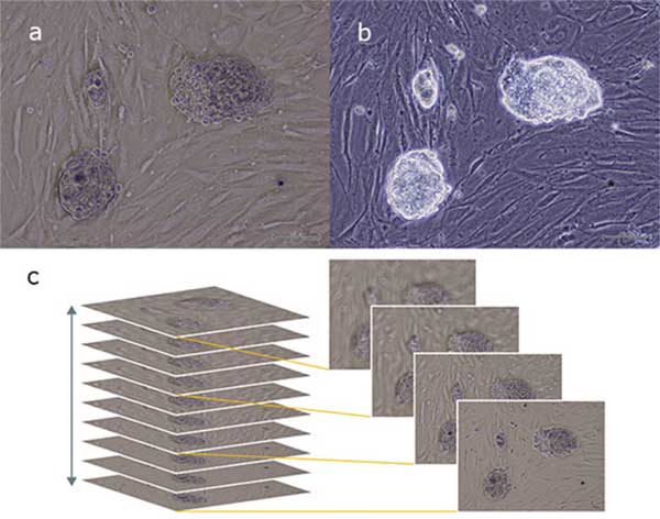 Figure 3: Mouse iPS Cell Colonies Documented with InVersion Contrast (IVC)
