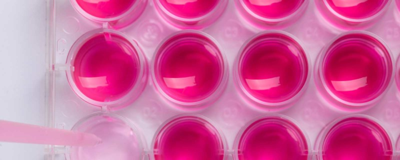 Cell Culture Advancements and Opportunities for Future Improvement