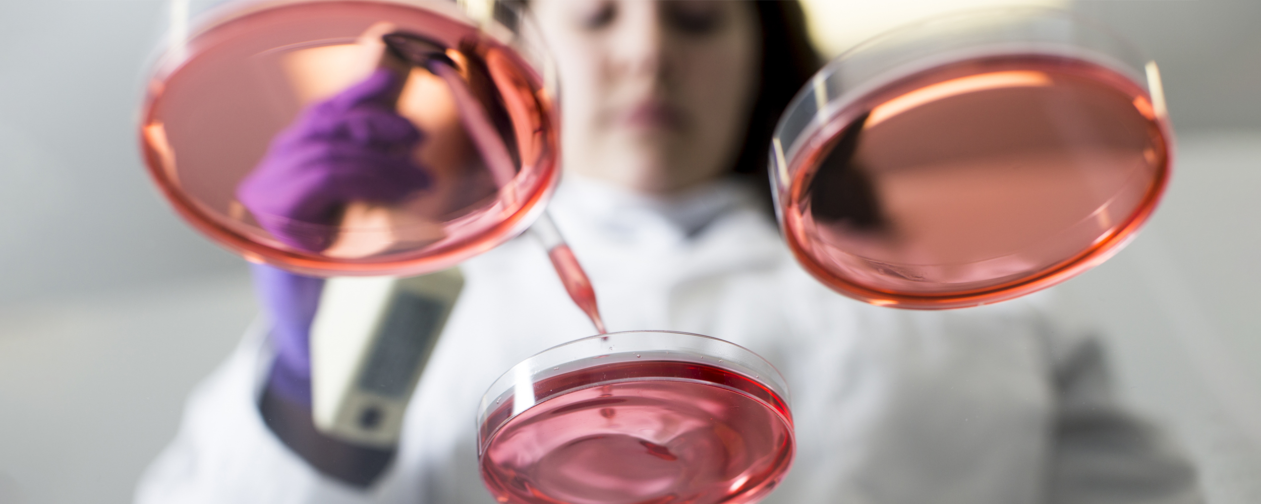 Understanding FBS Alternatives Frequently Asked Questions